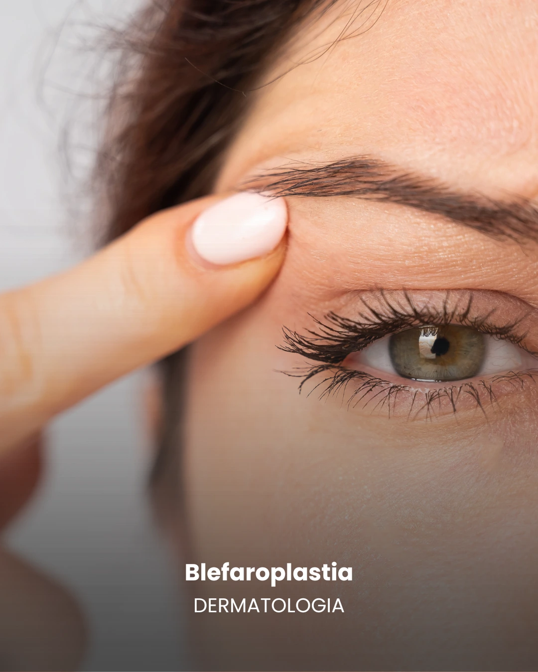 blefaroplastia