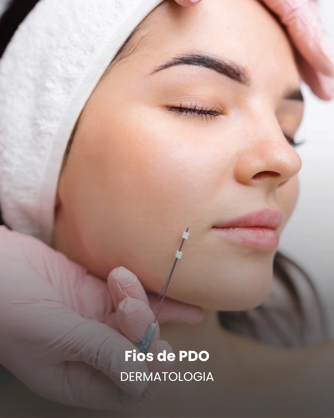 fiosdepdo